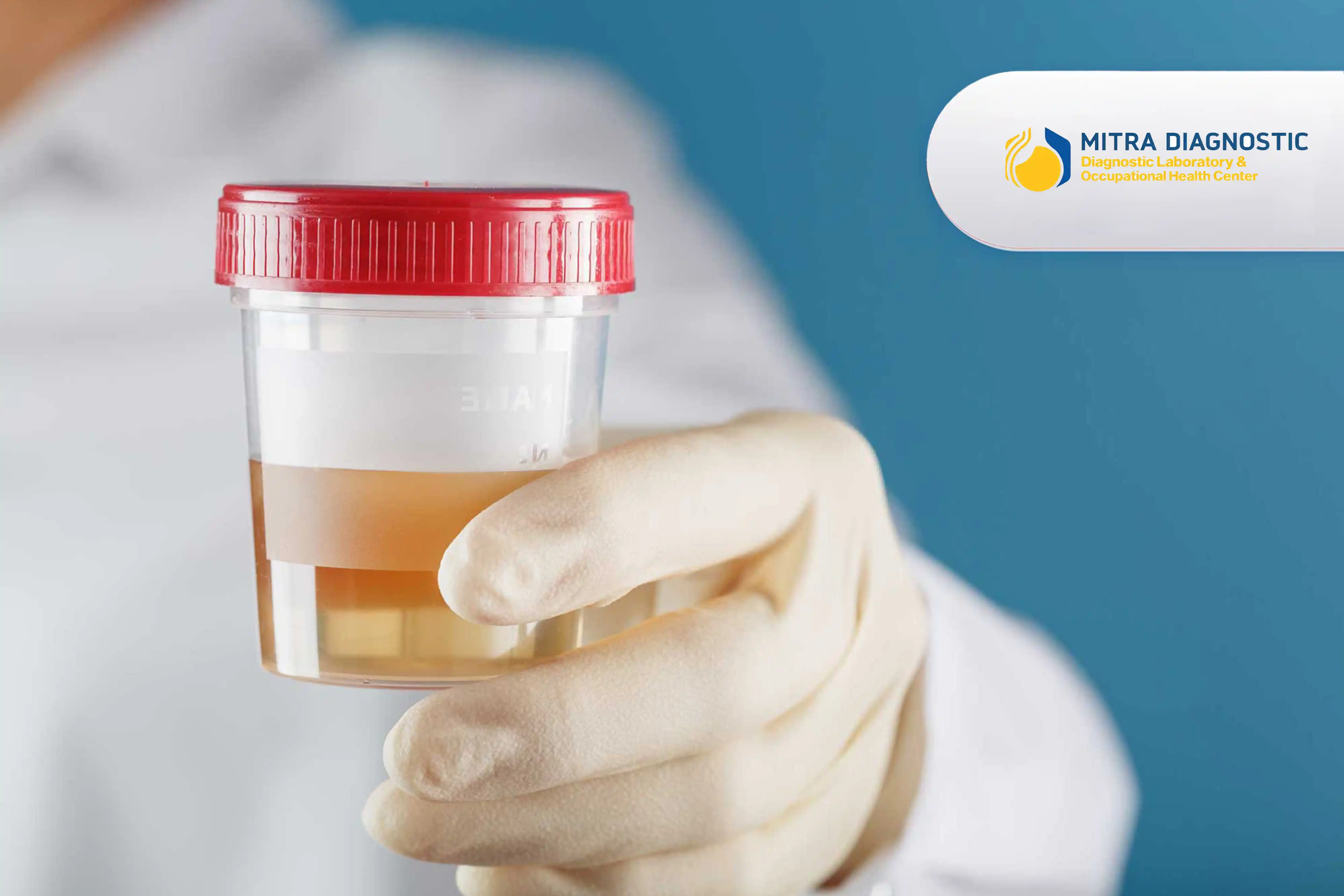 HPV Urine